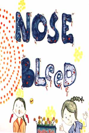 [9789386038678] Nose Bleed